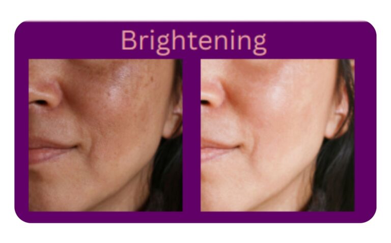 Brightening